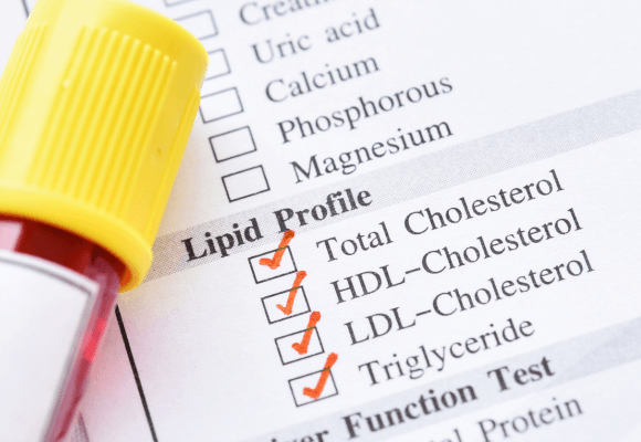 Diretrizes ESC EAS para Tratamento de Dislipidemias