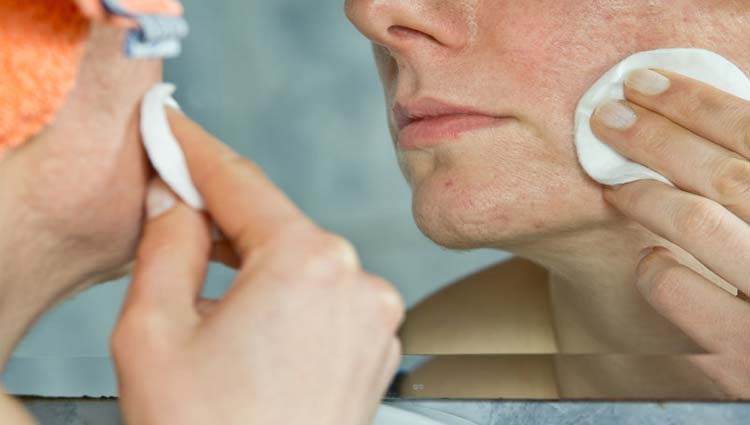 Tratamento eficaz para acne, mostrando produtos tópicos e orais em uma mesa