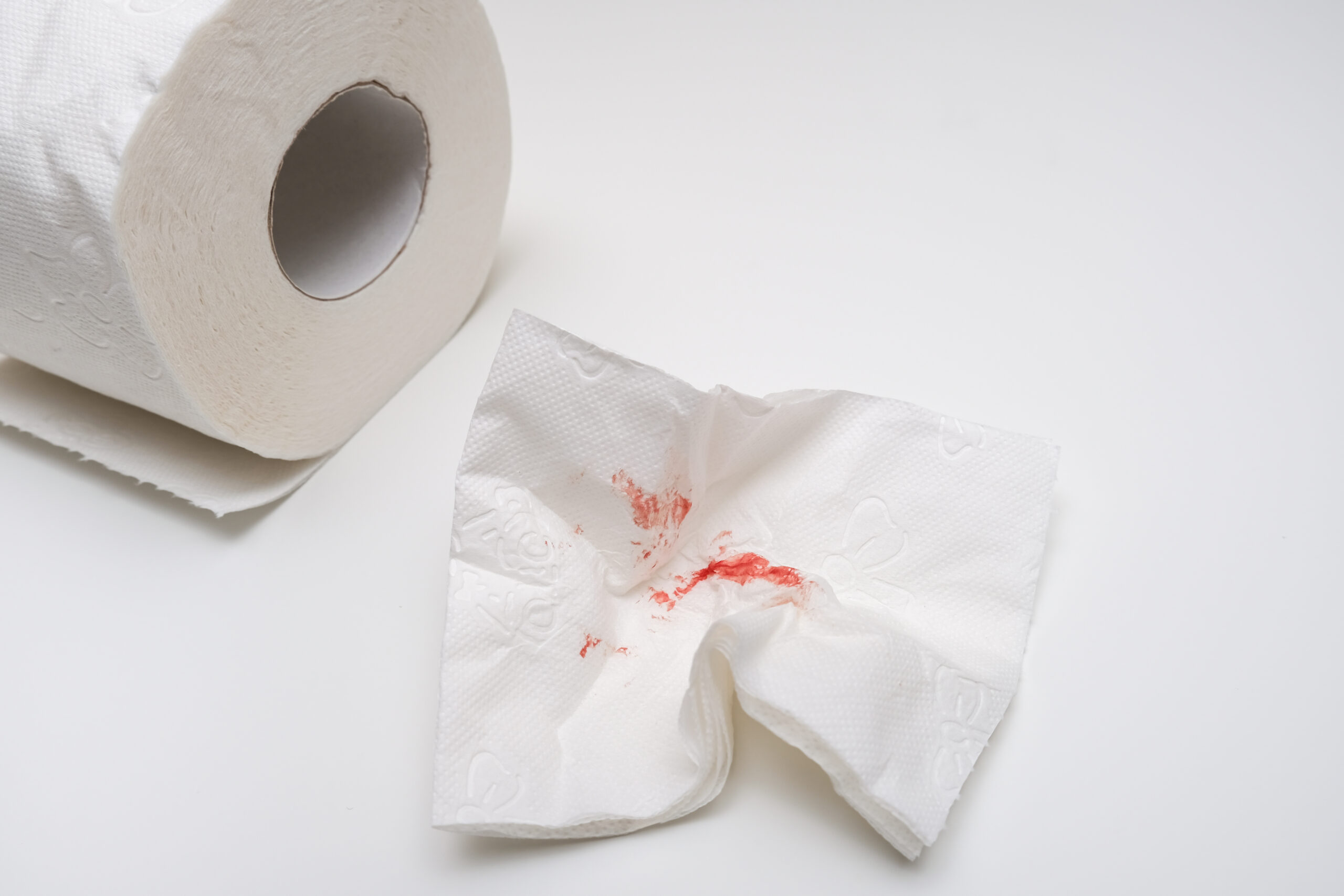 Homem preocupado após encontrar sangue no papel higiênico durante a evacuação