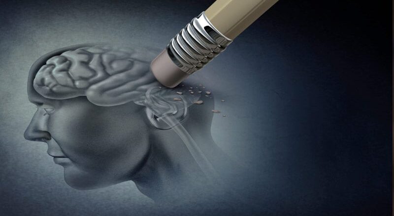 Cérebro humano com áreas afetadas pelo Mal de Alzheimer